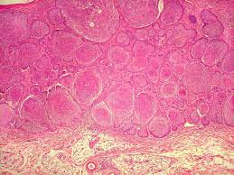 Anatomia Patológica